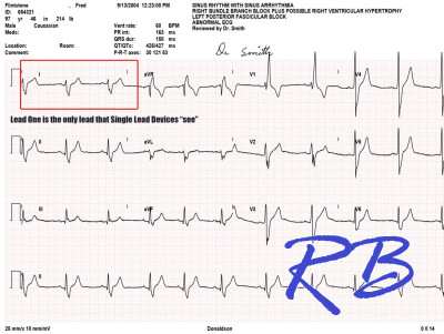 12leadECG.jpg