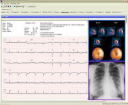 DICOM-is-able-to-unite-diagnostic-images-with-diagnostic-ECG-waveforms-The-clinician-has.png
